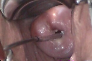 /images/Cervix Play Insertion. Uterus fucking