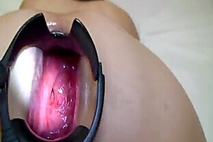/images/Gaping anal speculum stretching and dildo fuck