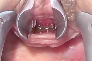 /images/Masturbate Peehole with Toothbrush and Chain into Urethra
